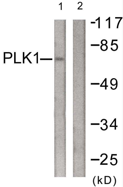 Anti-PLK1 Antibody Anti-PLK1 Antibody