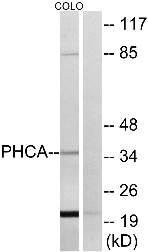 Anti-PHCA Antibody