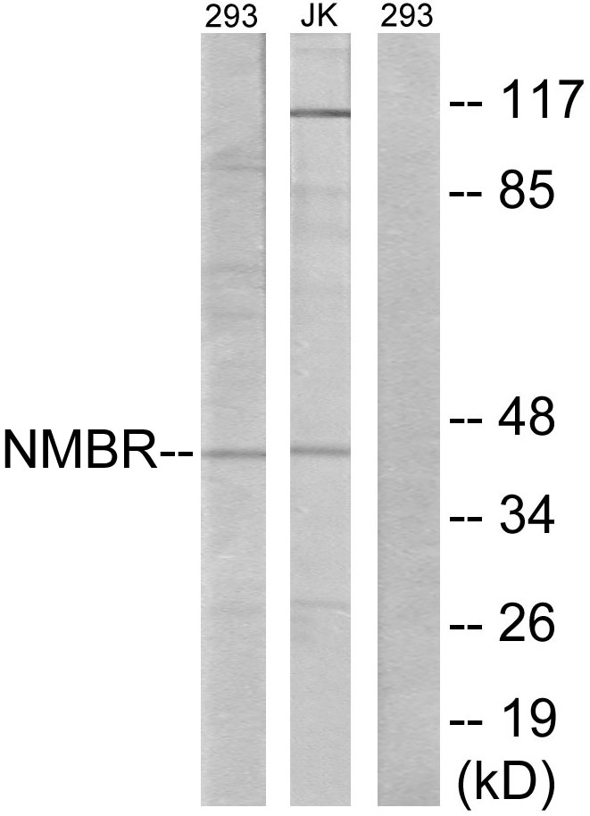 Anti-NMBR Antibody