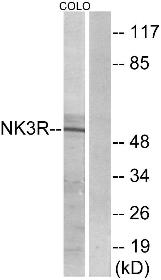 Anti-NK3R Antibody - Identical to Sigma (SAB4502914)