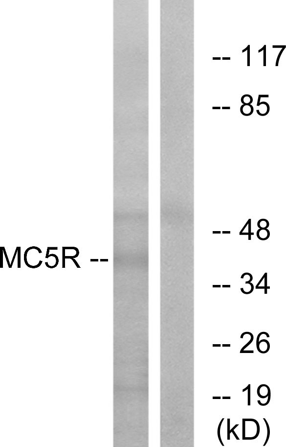 Anti-MC5R Antibody
