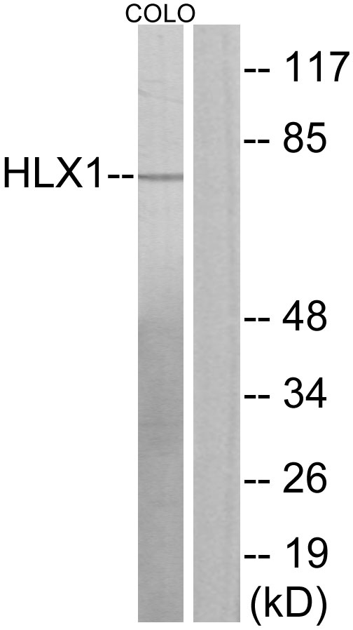 Anti-HLX1 Antibody