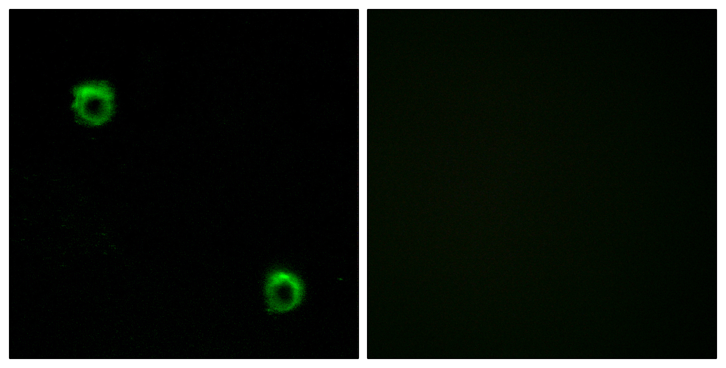 Anti-FZD2 Antibody