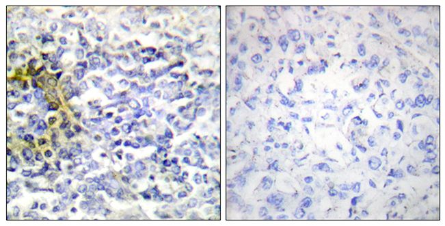 Anti-FXR2 Antibody Anti-FXR2 Antibody
