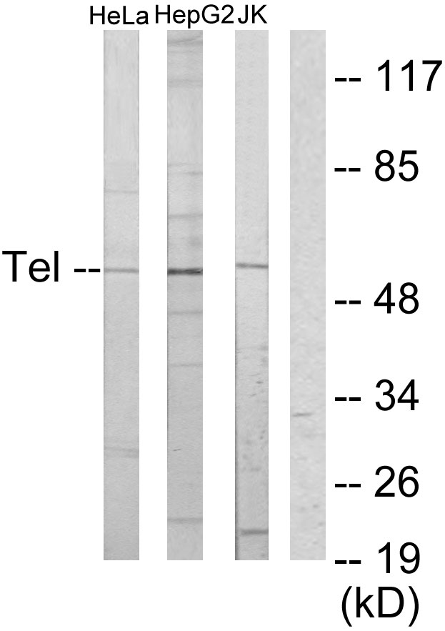 Anti-ETV6 Antibody - Identical to Abcam (ab64909)