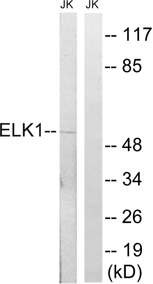 Anti-Elk1 Antibody