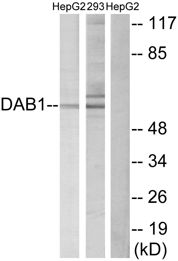 Anti-Dab1 Antibody - Identical to Abcam (ab189426)