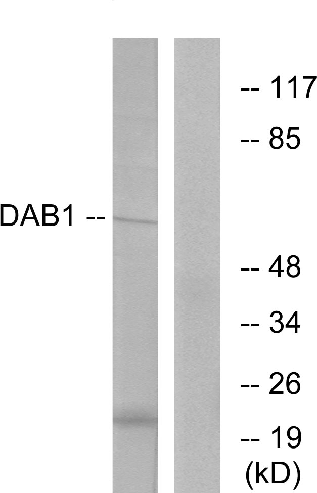 Anti-Dab1 Antibody