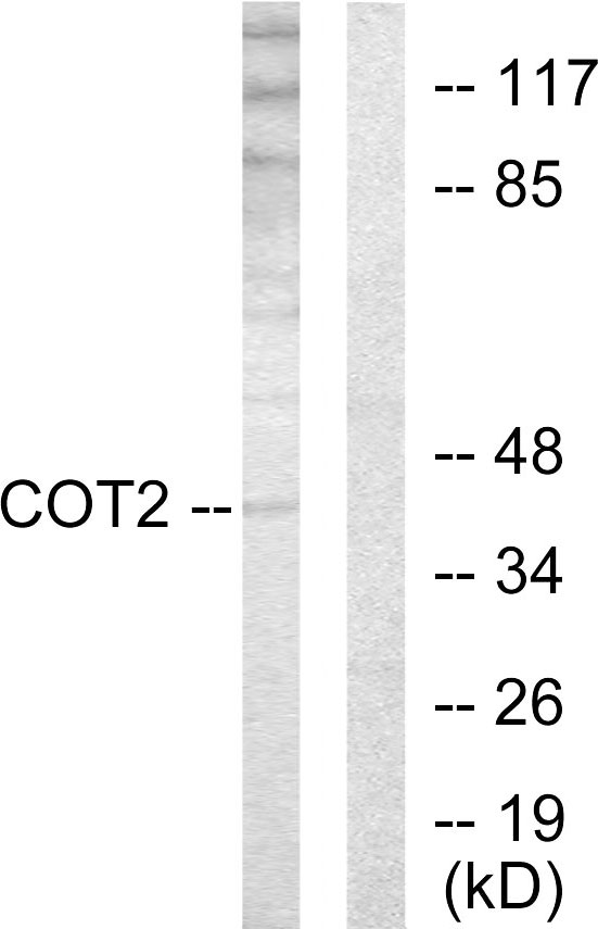 Anti-COT2 Antibody