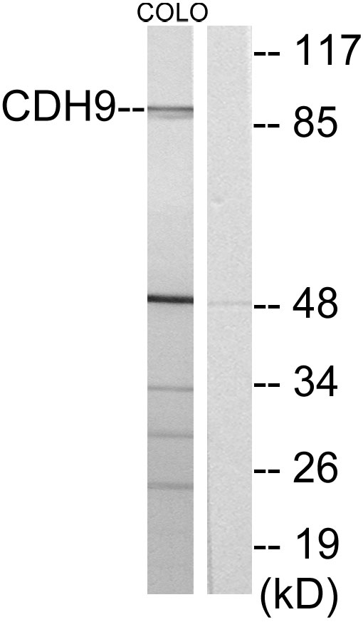 Anti-CDH9 Antibody