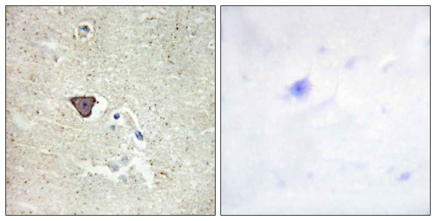 Anti-CDH9 Antibody Anti-CDH9 Antibody