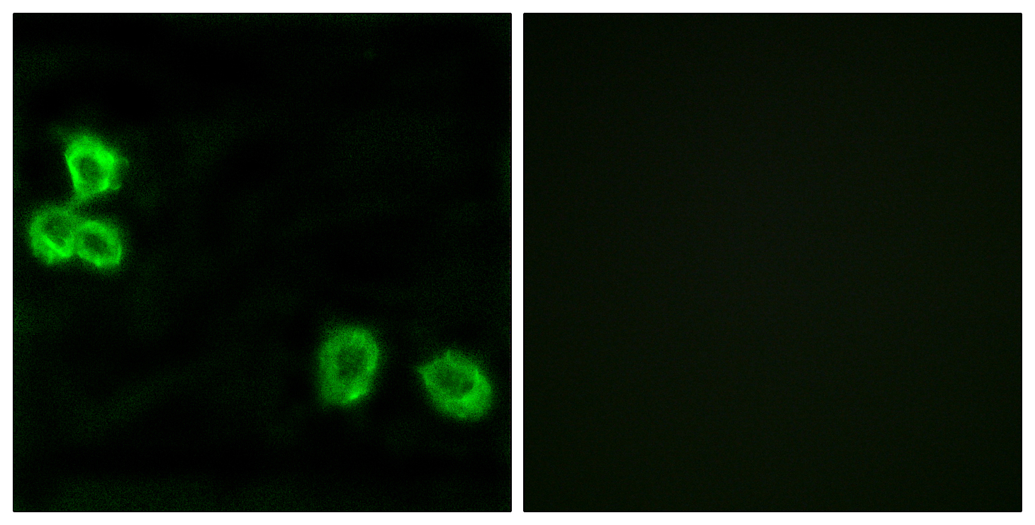 Anti-BAI1 Antibody