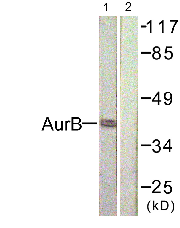 Anti-AurB Antibody