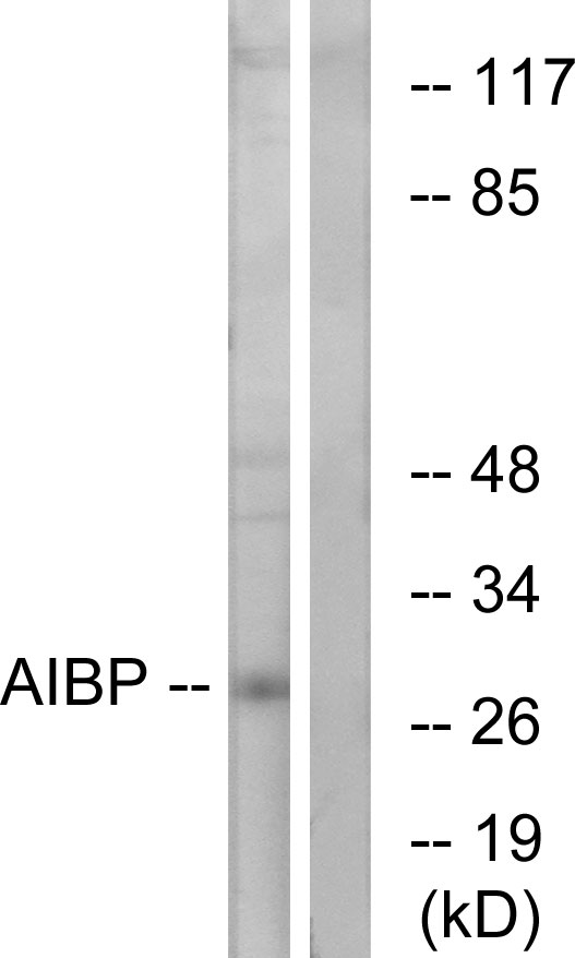 Anti-AIBP Antibody - Identical to Abcam (ab75114) Anti-AIBP Antibody - Identical to Abcam (ab75114)