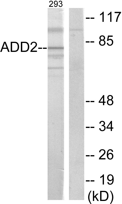 Anti-ADD2 Antibody