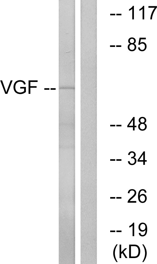 Anti-VGF Antibody