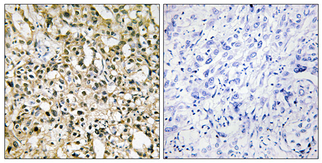 Anti-MYC Antibody Anti-MYC Antibody