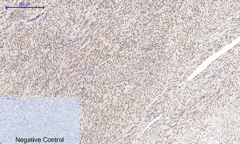 Anti-MYC Antibody Anti-MYC Antibody