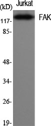 Anti-FAK Antibody Anti-FAK Antibody