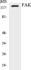 Anti-FAK Antibody