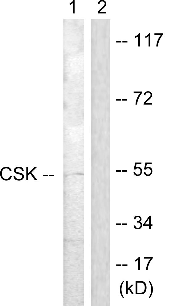 Anti-CSK Antibody