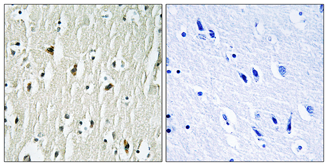 Anti-CSK Antibody Anti-CSK Antibody