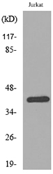 Anti-SERPINB3 + SERPINB4 Antibody