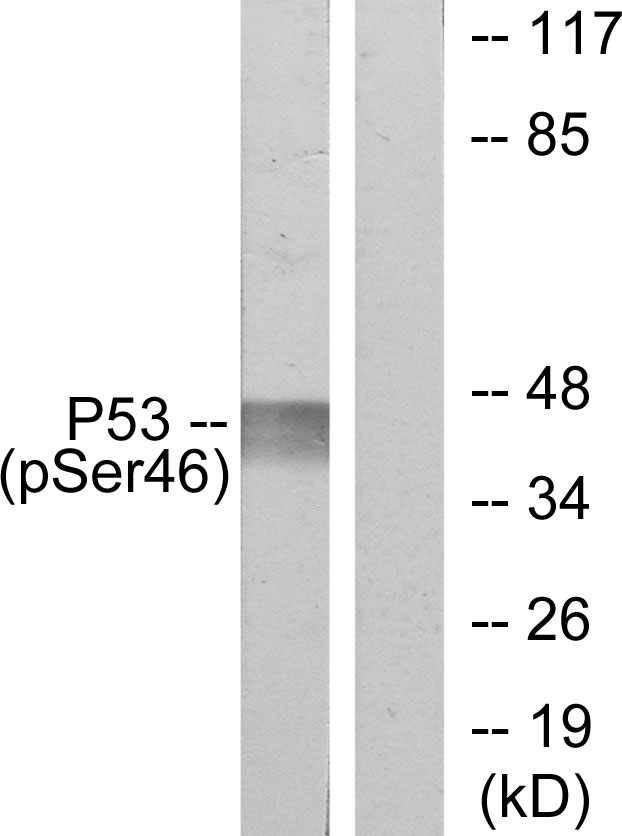 Anti-p53 (phospho Ser46) Antibody