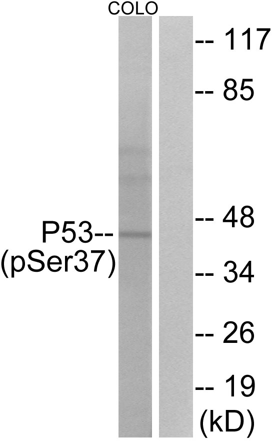 Anti-p53 (phospho Ser37) Antibody
