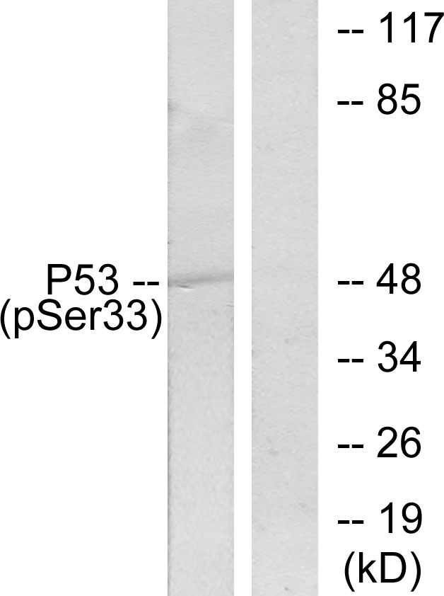 Anti-p53 (phospho Ser33) Antibody