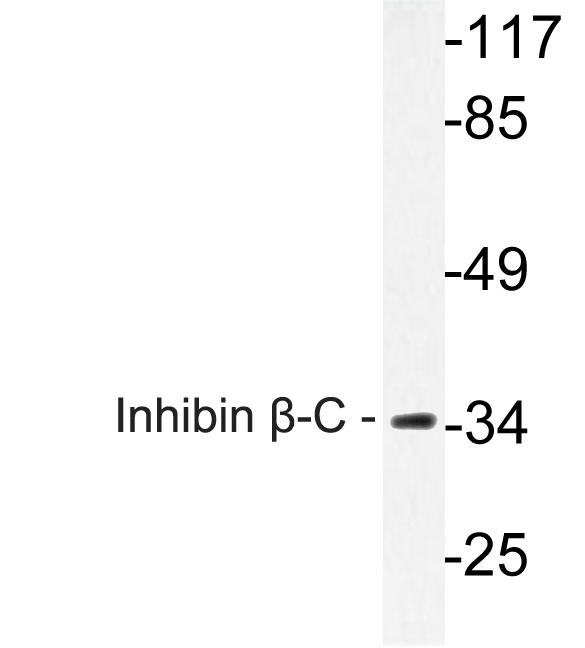 Anti-Inhibin beta-C Antibody
