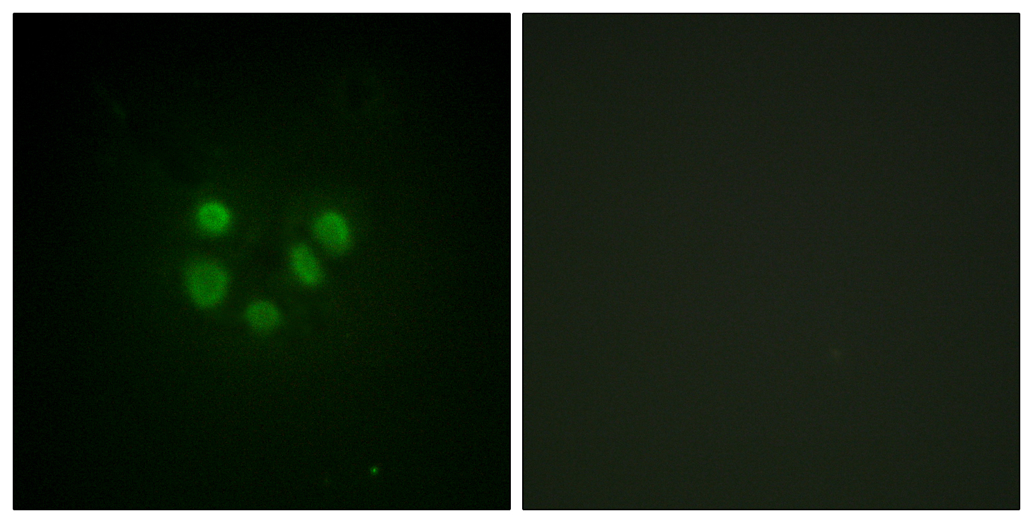 Anti-Bloom Syndrome Antibody