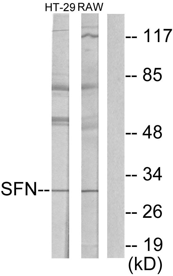 Anti-14-3-3 sigma Antibody
