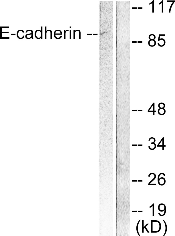Anti-E-cadherin Antibody