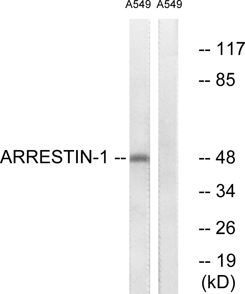 Anti-Arrestin 1 Antibody