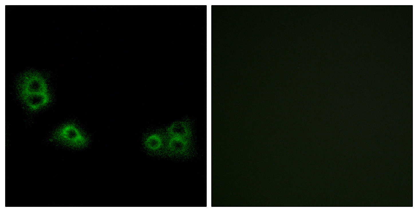 Anti-TMEM185A Antibody - Identical to Abcam (ab130101)