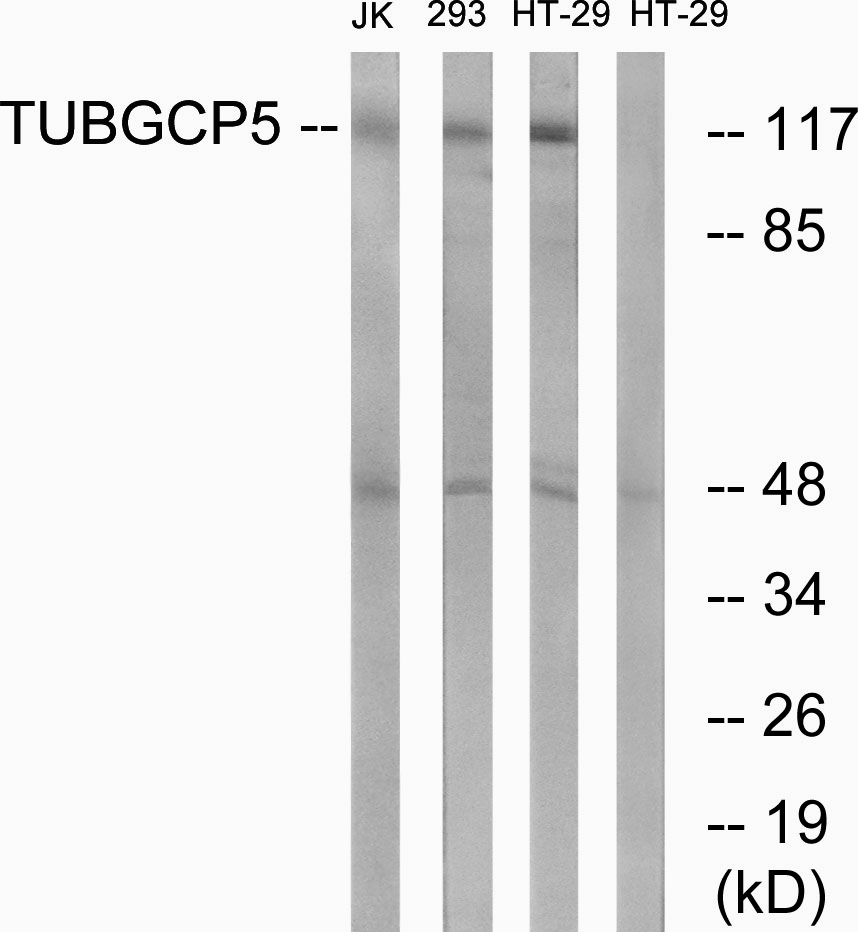 Anti-TUBGCP5 Antibody