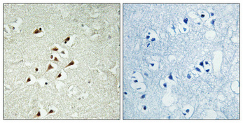 Anti-TUBGCP5 Antibody Anti-TUBGCP5 Antibody