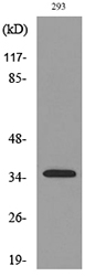 Anti-TNFSF11 Antibody