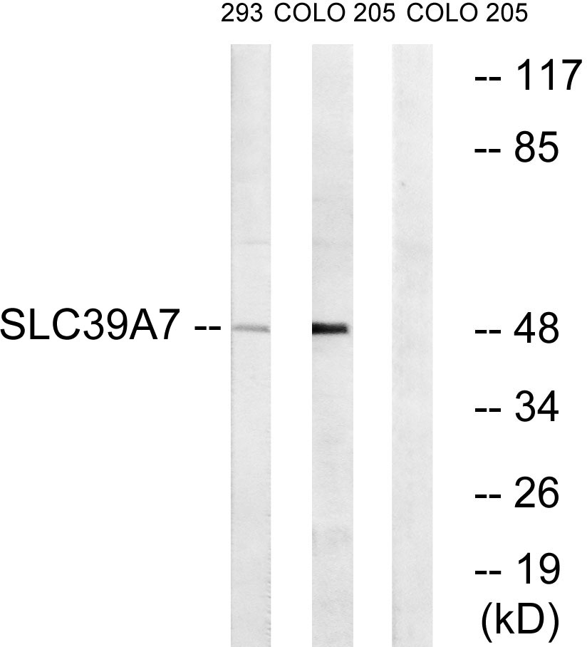 Anti-SLC39A7 Antibody