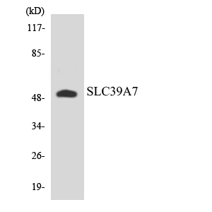 Anti-SLC39A7 Antibody