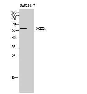 Anti-SLC24A4 Antibody Anti-SLC24A4 Antibody