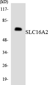 Anti-SLC16A2 Antibody
