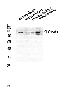 Anti-SLC15A1 Antibody