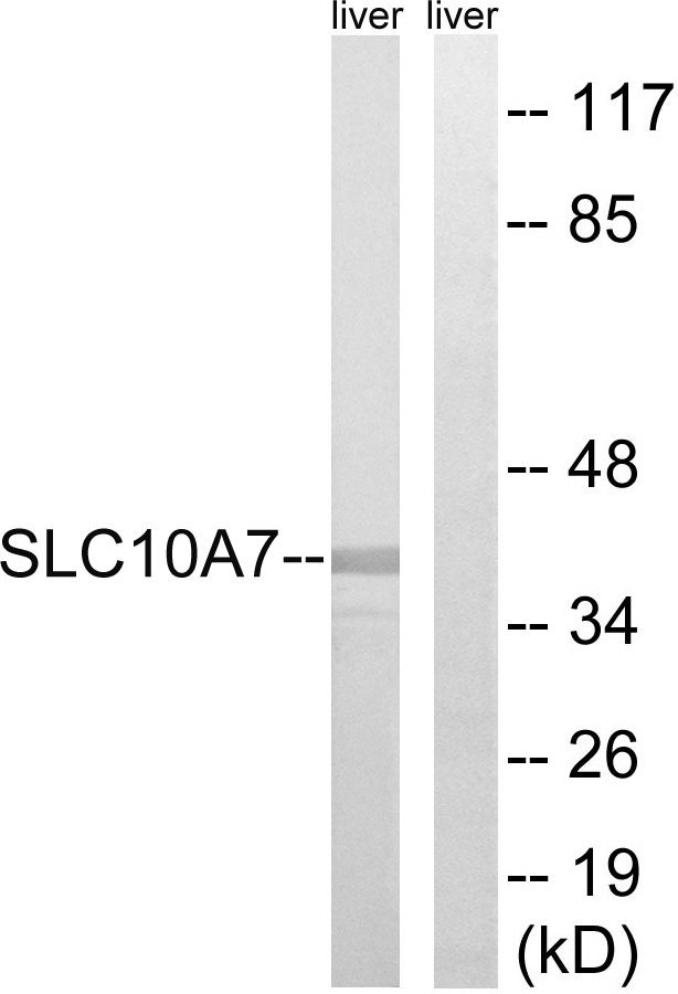 Anti-SLC10A7 Antibody
