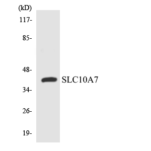 Anti-SLC10A7 Antibody
