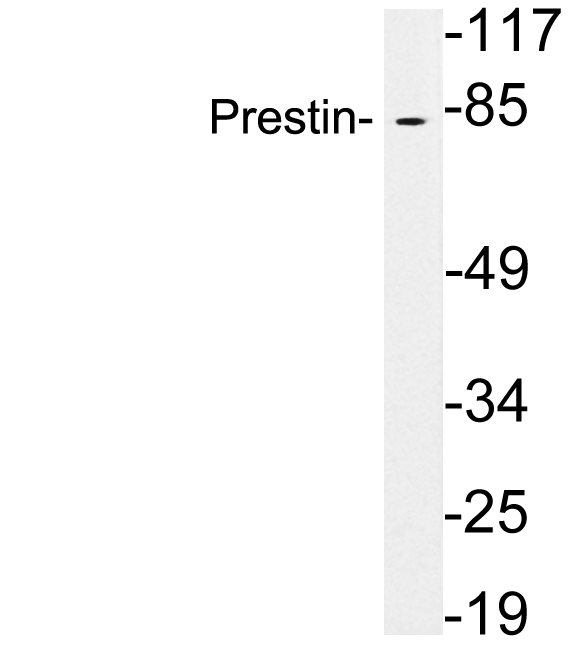 Anti-Prestin Antibody