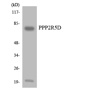 Anti-PPP2R5D Antibody
