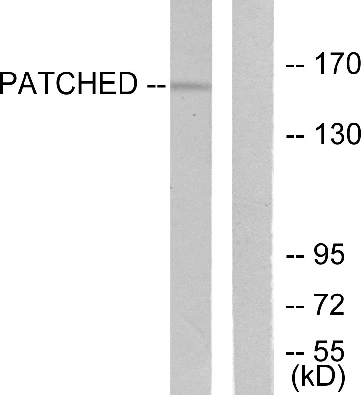 Anti-Patched Antibody - Identical to Abcam (ab53715)