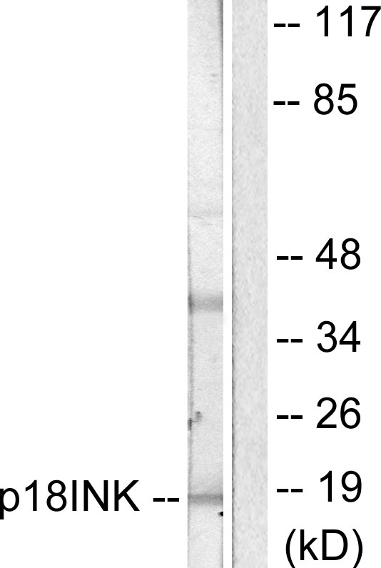Anti-p18 INK Antibody